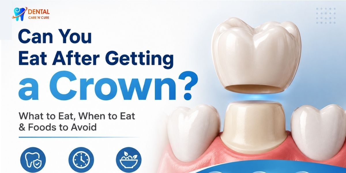 Can you eat after getting a crown? Foods to eat and avoid after crown placement